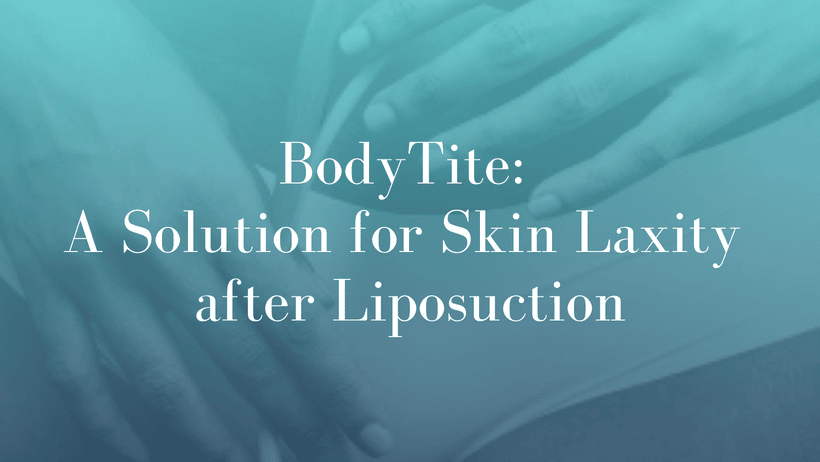 BodyTite_ A Solution for Skin Laxity after Liposuction