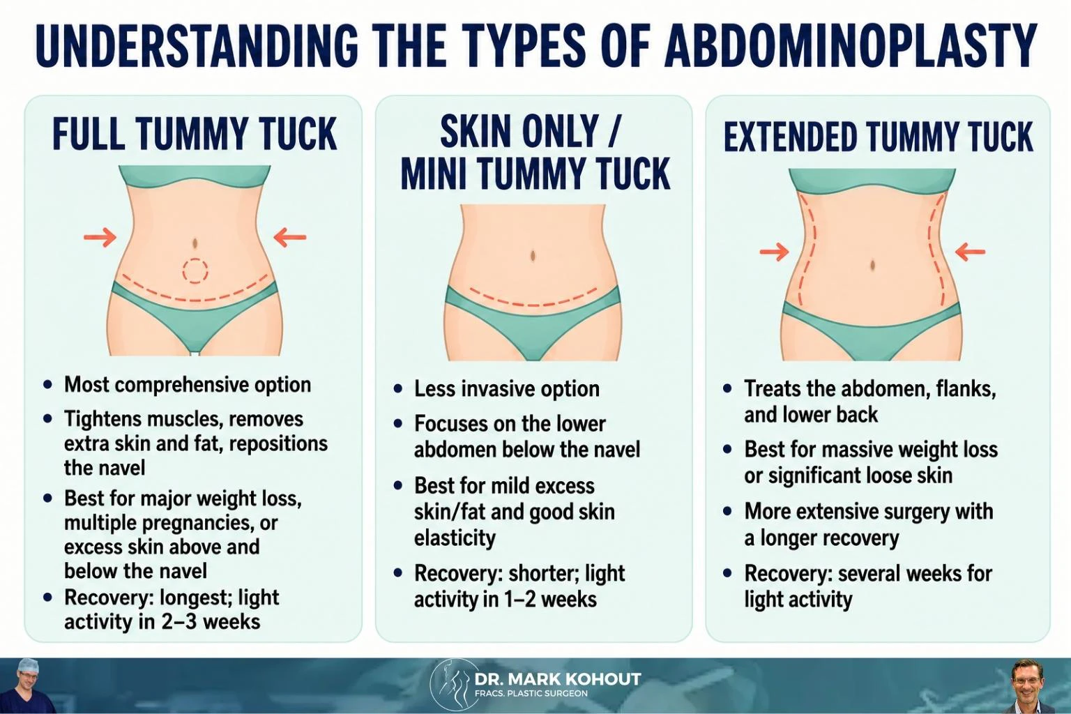 Different Types of Abdominoplasty – Tummy Tuck Surgeries Infographics - Mark Kohout