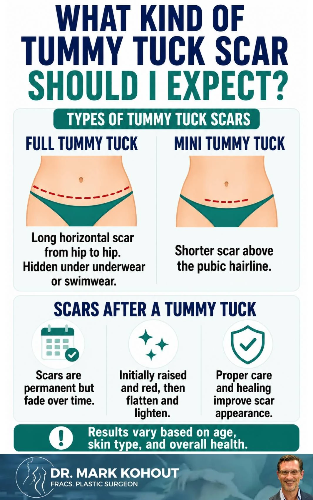 Managing Abdominoplasty Tummy Tuck Scars Infographics - Mark Kohout