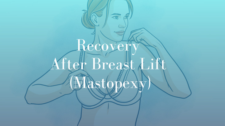 Recovery After Breast Lift (Mastopexy) 2 Blog Dr Mark Kohout 2025 Plastic Surgery Featured