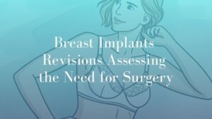 Breast Implants Revisions Assessing the Need for Surgery - Breast Image sydney Dr. Mark Kohout