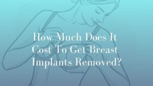 How Much Does It Cost To Get Breast Implants Removed - Cost breast surgery image Dr. Mark Kohout