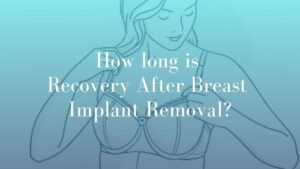 How long is Recovery After Breast Implant Removal - Surgery Image breast Sydney Dr. Mark Kohout