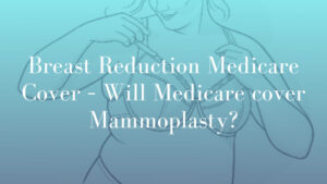 Breast Reduction Medicare Cover – Will Medicare cover Mammoplasty by Dr Mark Kohout 2025 Blog Image