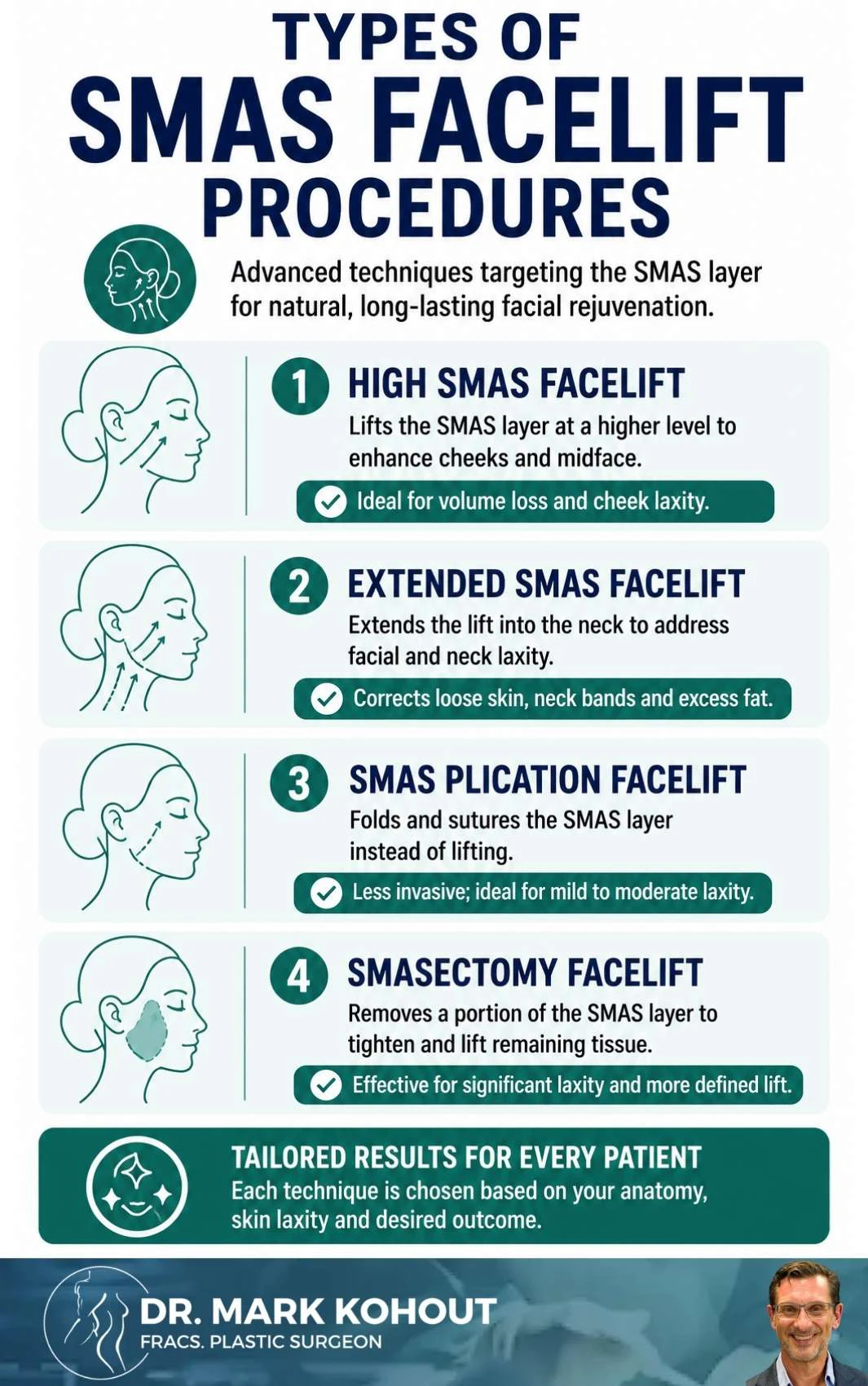 Different Techniques for SMAS Facelift Infographics - Mark Kohout