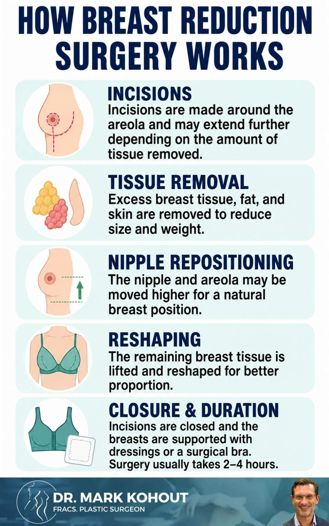 Reducing Back Pain With Breast Reduction Surgery Infographics - Mark Kohout