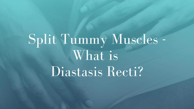 Split Tummy Muscles - What is Diastasis Recti