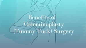 Benefits of Abdominoplasty (Tummy Tuck) Surgery - Image Dr. Mark Kohout