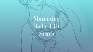 Managing Body Lift Scars - Image Dr. Mark kohout