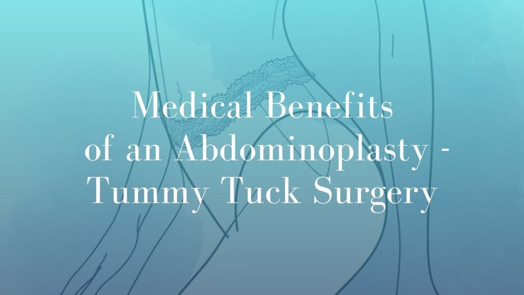 Medical Benefits of an Abdominoplasty - Tummy Tuck Surgery - Image Sydney Dr. Mark Kohout