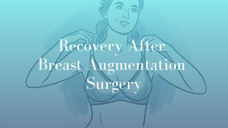 Recovery After Breast Augmentation Surgery