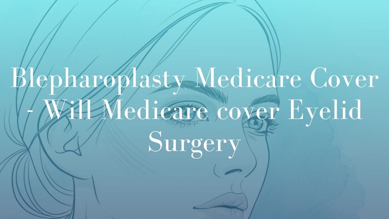 Blepharoplasty Medicare Cover - Will Medicare cover Eyelid Surgery- Dr. Mark Kohout image