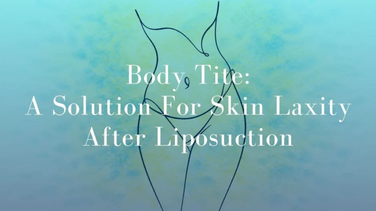 BodyTite: A Solution for Skin Laxity after Liposuction