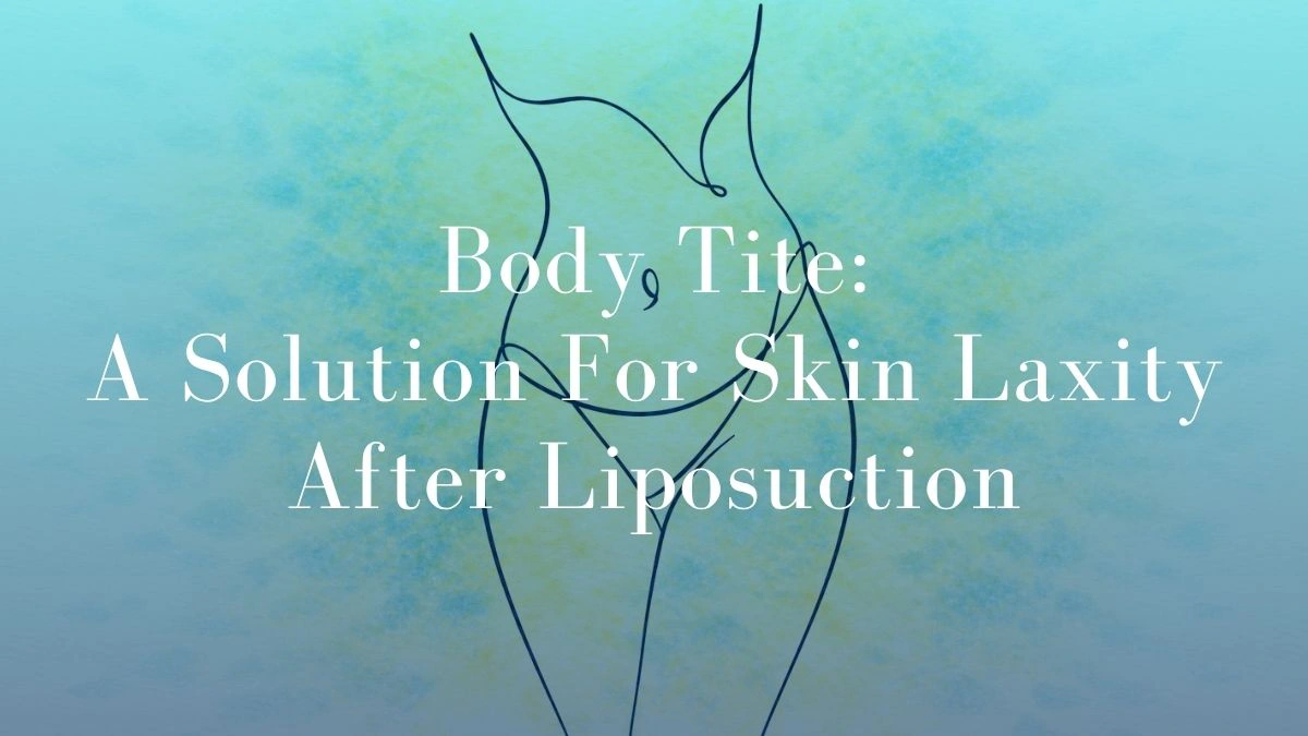 Body Tite A Solution For Skin Laxity After Liposuction - Mark Kohout
