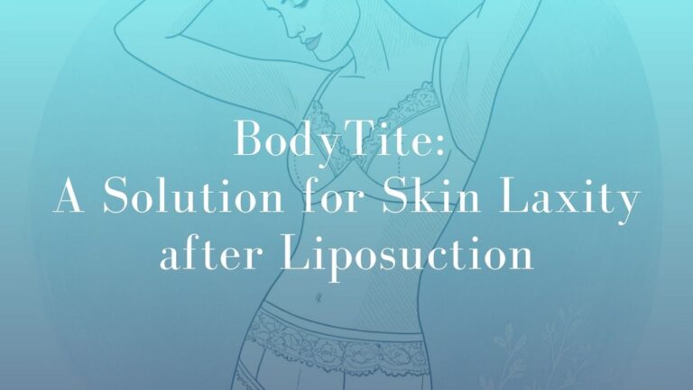 BodyTite: A Solution for Skin Laxity after Liposuction