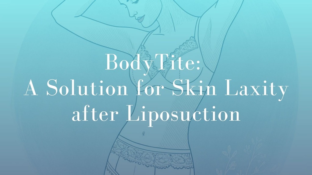BodyTite A Solution for Skin Laxity after Liposuction