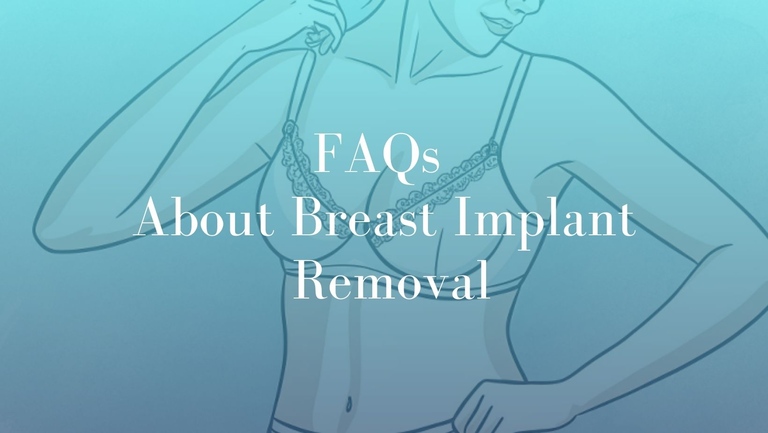 FAQs About Breast Implant Removal - Image Mark Kohout