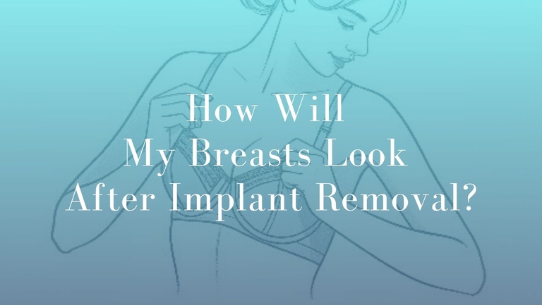 How Will My Breasts Look After Implant Removal - Dr Kohout