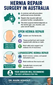 Can I have a Hernia Repair with Abdominoplasty Surgery Infographics by Dr Mark Kohout