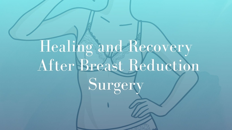 Healing and Recovery After Breast Reduction Surgery - Image Mark Kohout