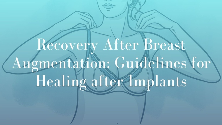 Recovery After Breast Augmentation_ Guidelines for Healing after Implants