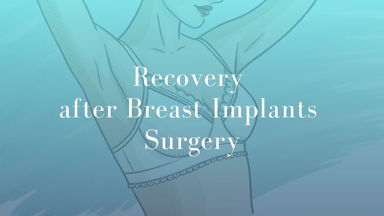 Recovery after Breast Implants Surgery - Dr Mark Kohout