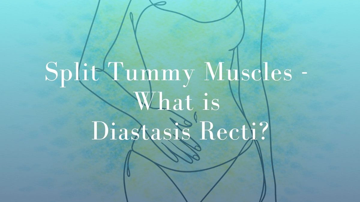 Split Tummy Muscles - What is Diastasis Recti