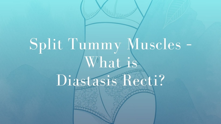 Split Tummy Muscles – What is Diastasis Recti - Dr Mark Kohout