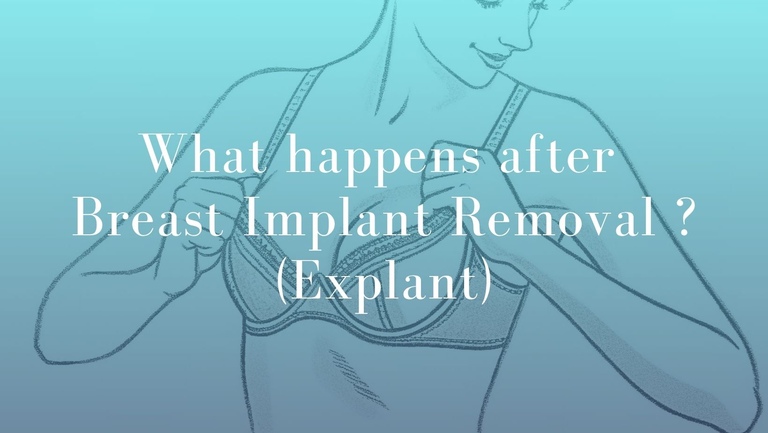 What happens after Breast Implant Removal _ (Explant) - Mark Kohout