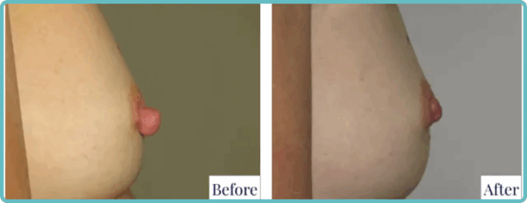 image-3-8