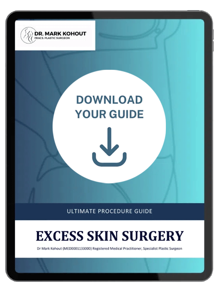 Ultimate Procedure Guide - Excess Skin Surgery Card Image