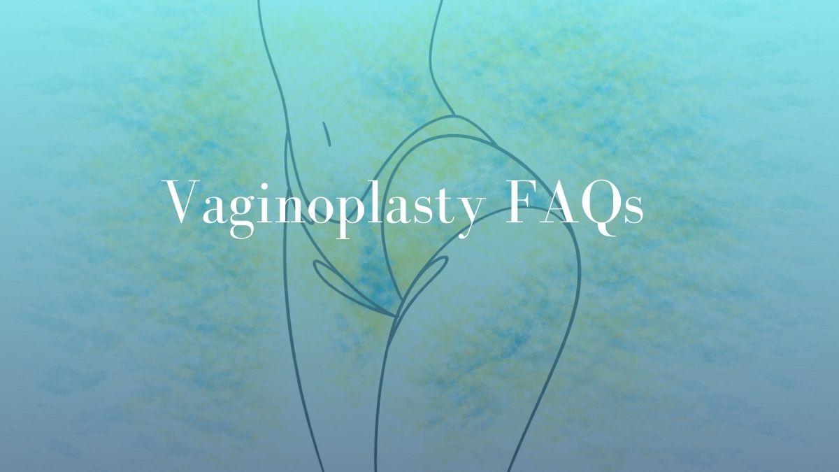 Vaginoplasty FAQs - Dr mark kohout