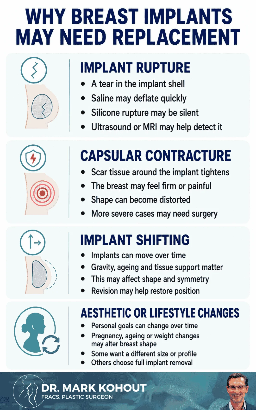 How Long Do Breast Implants Last - Infographics Mark Kohout