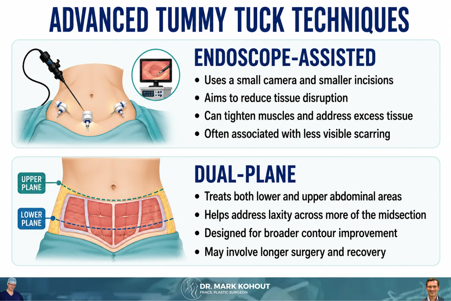 Techniques in Tummy Tuck – Abdominoplasty - Infographics Mark Kohout