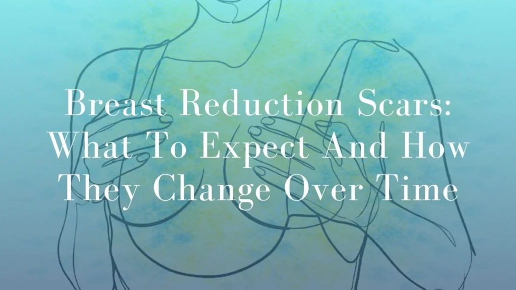 Breast Reduction Scars What To Expect And How They Change Over Time - Mark Kohout