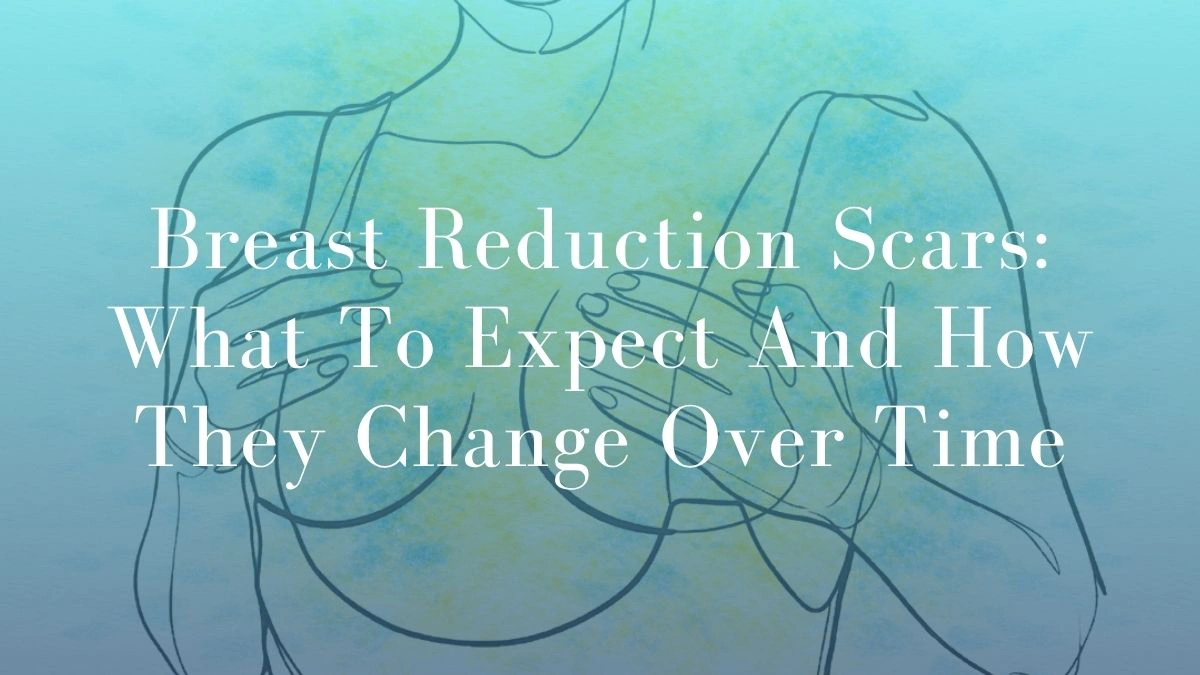 Breast Reduction Scars What To Expect And How They Change Over Time - Mark Kohout