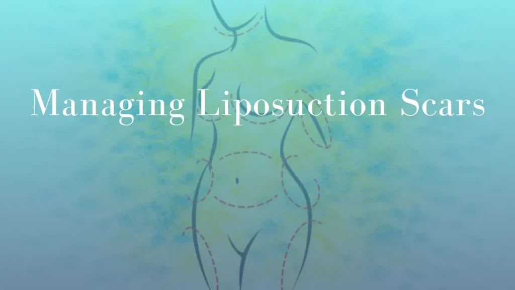 Managing Liposuction Scars by Dr Mark Kohout