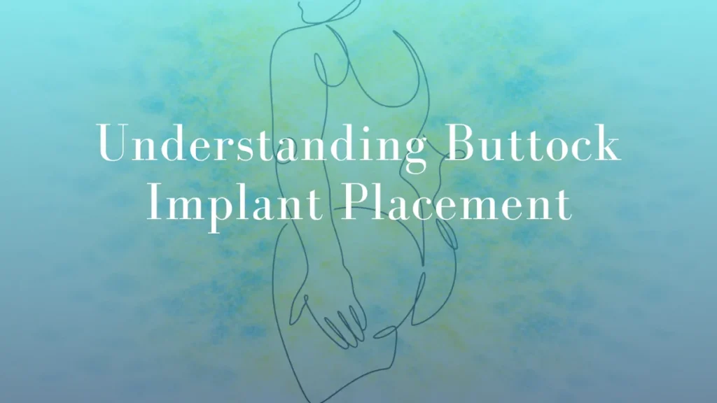 Understanding Buttock Implant Placement by Dr Mark Kohout