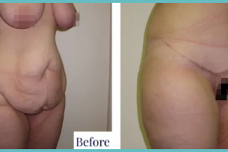 View Recovery Transition