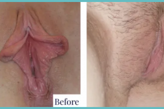 image-7-8